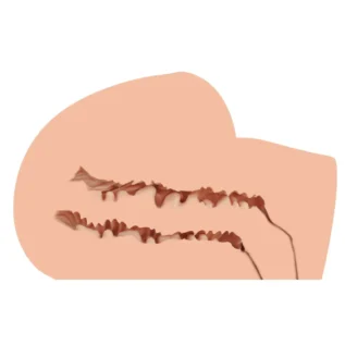 Alternative view of Мастурбатор-півторс Naked Factory SCARLET, вагіна + анус, вузький вхід, дуже реалістичний, наскрізний